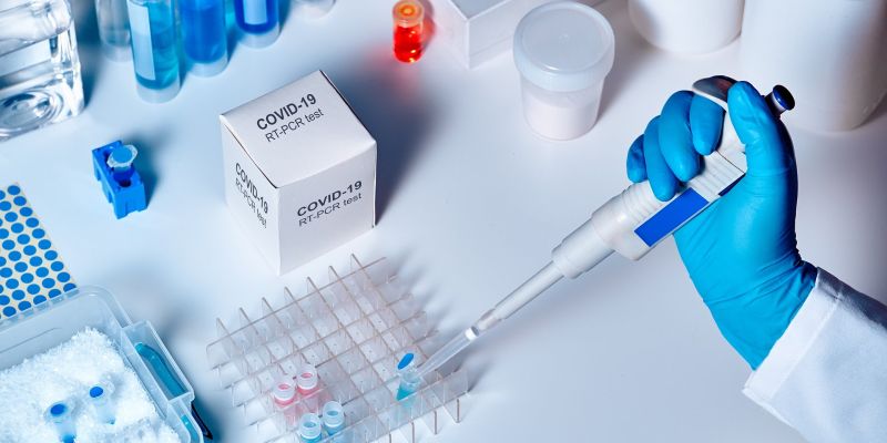 Banki wspierają walkę z koronawirusem. PKO BP zakupił 7,5 tys. testów